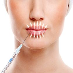 aplicação de botox garopaba santa catarina