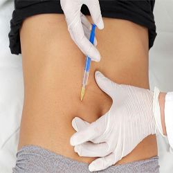lipo enzimática | mesoterapia