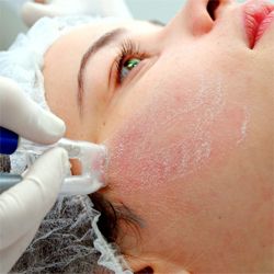 peeling de cristal garopaba